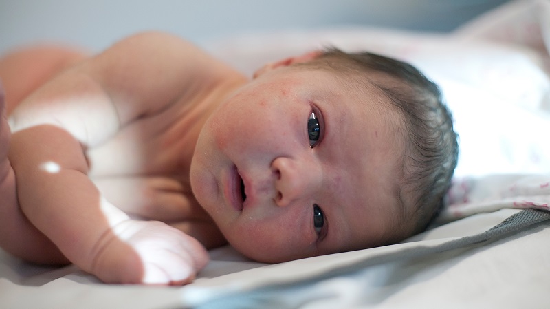 Brückner-Test, Kinderrichtlinie, Sehstörungen bei Kindern